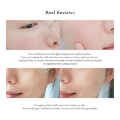 Skin Relief Essence -Cosrx Shop 20221103 1080 4 5ffbdd51 8e06 4816 a91b 8999e5edf67e 1000x jpg
