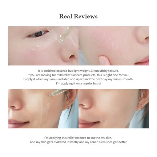 Skin Relief Essence - Image 7