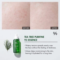 Tea Tree Purifine 95 Essence -Cosrx Shop 325284129 1050877076307318 789526396265858086 n