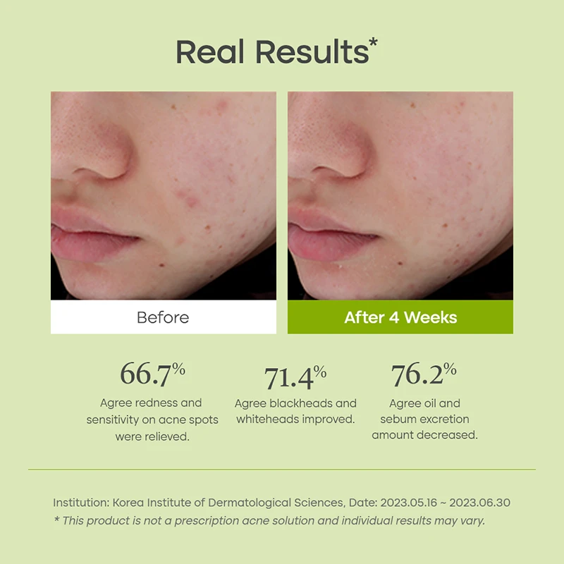 Clear Code Superfruit Serum 6 Clear Code Superfruit Serum - Image 6