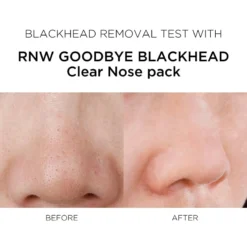 2 STEP Clear Nose Pack -Cosrx Shop 41 jpg