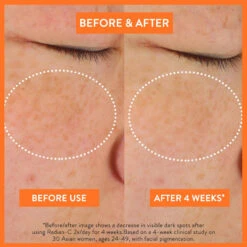 LANEIGE Radian-C Cream -Cosrx Shop LANEIGE RC BEFORE AFTER 2000X2000 d5aa5ec3 ac87 44fa 9a4b 94214bd8cd77