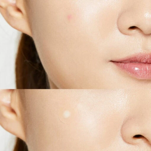 Cosrx Acne Pimple Master Patches - Image 6