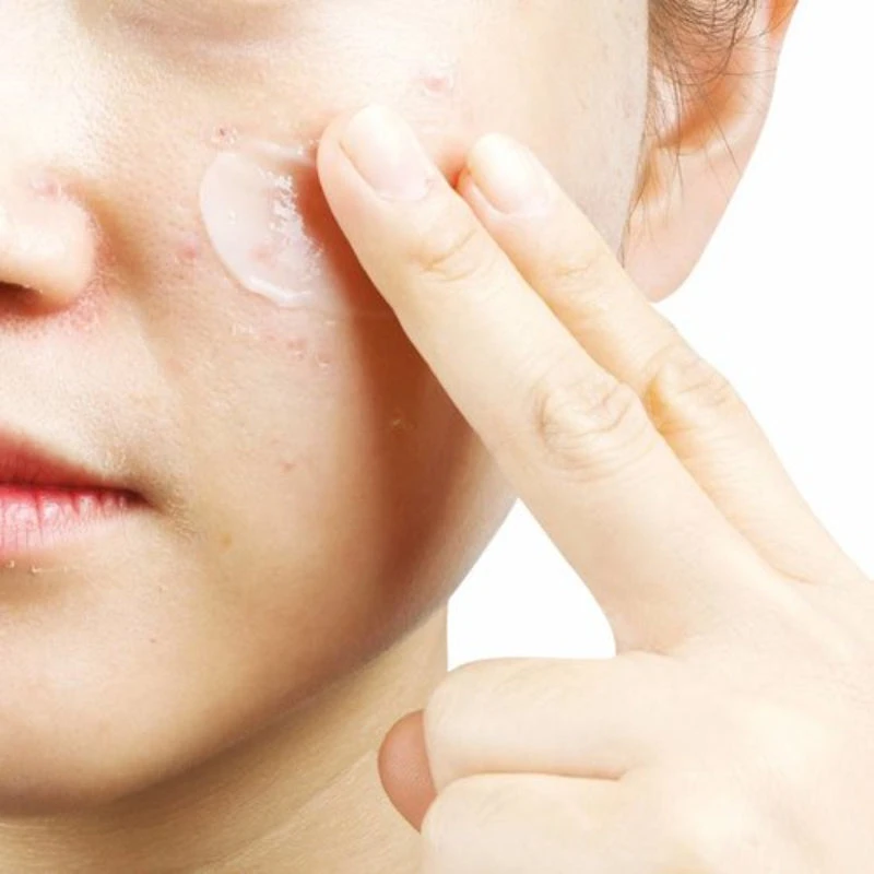 Anti-T Cream 2 Anti-T Cream - Image 2